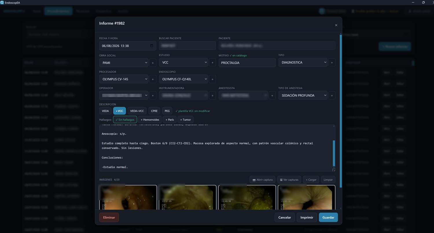 Carga de un procedimiento en el software